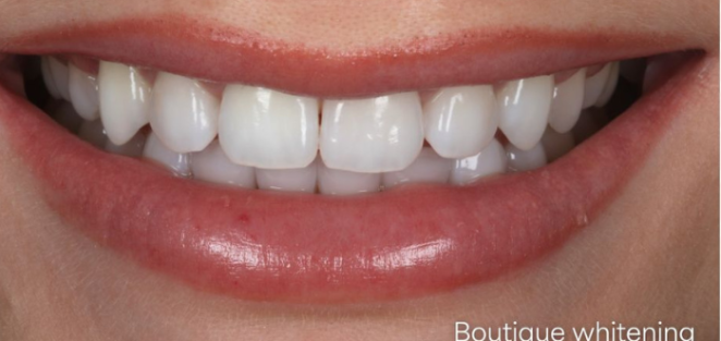 Naveed patel-Treatment Thumb